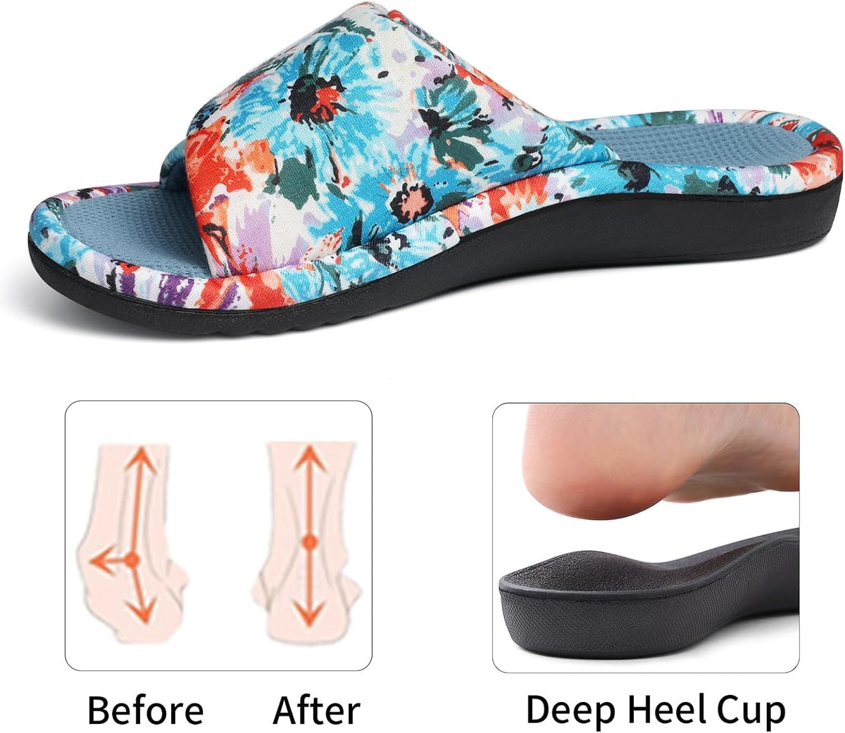 Women's Orthopedic Summer Slippers with Arch Support for Plantar Fasciitis
